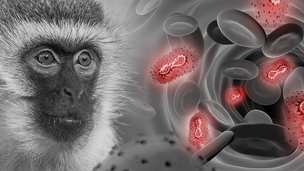 Se confirmó el primer caso de viruela del mono en Foz de Iguazú
